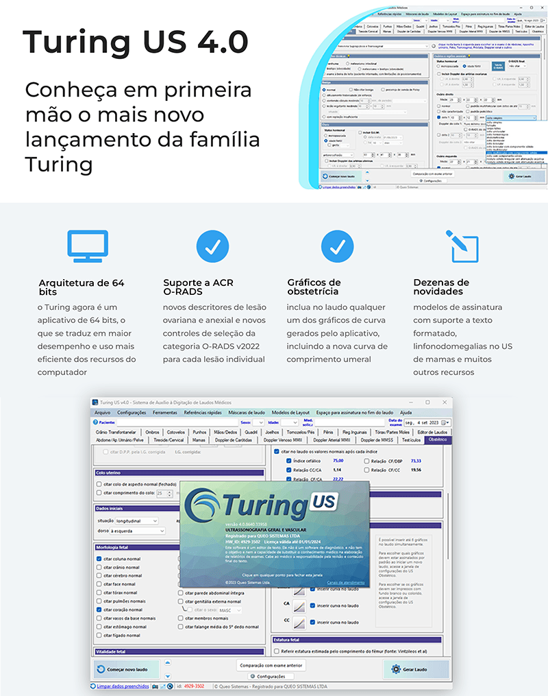 Anúncio do lançamento do Turing US 4.0 com novidades e captura da interface