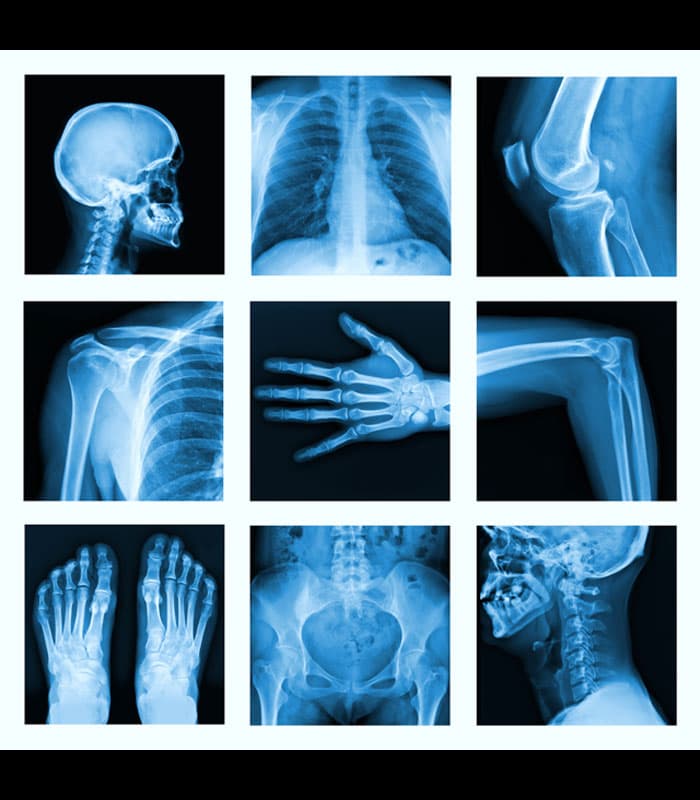 Coleção de radiografias de diferentes regiões do corpo
